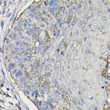 Immunohistochemistry - Anti-TROP2 Antibody (A10307) - Antibodies.com