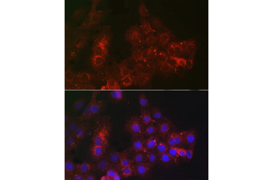 Immunofluorescence - Anti-TROP2 Antibody (A10307) - Antibodies.com