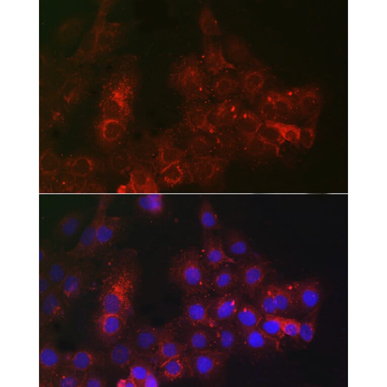 Immunofluorescence - Anti-TROP2 Antibody (A10307) - Antibodies.com