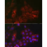 Immunofluorescence - Anti-TROP2 Antibody (A10307) - Antibodies.com