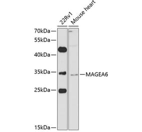 Western Blot - Anti-MAGEA6 Antibody (A10308) - Antibodies.com