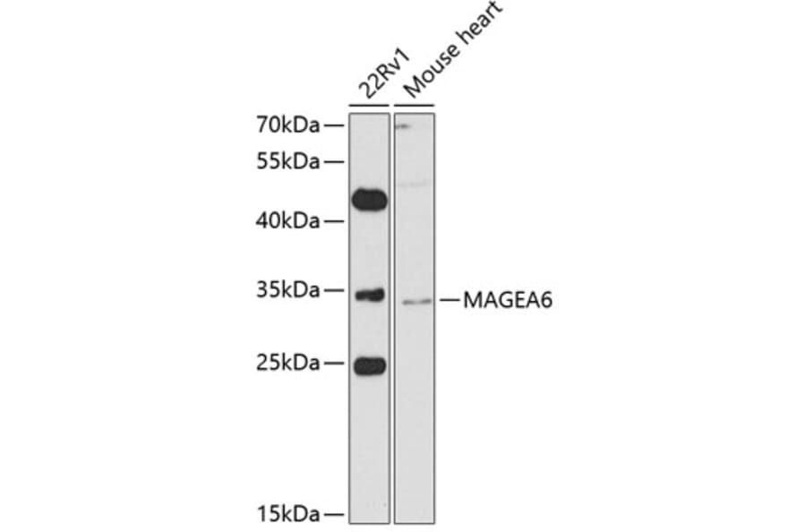 Western Blot - Anti-MAGEA6 Antibody (A10308) - Antibodies.com