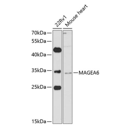 Western Blot - Anti-MAGEA6 Antibody (A10308) - Antibodies.com