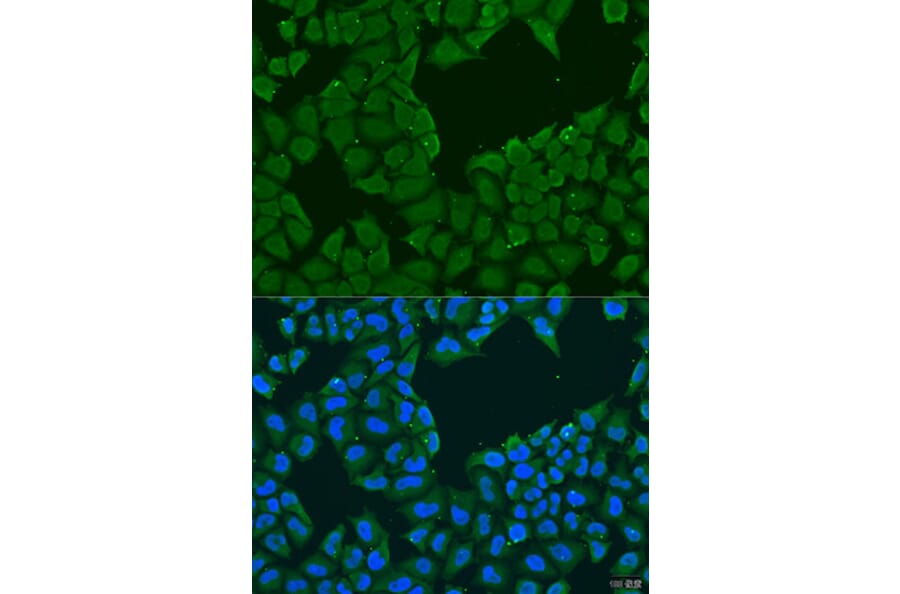 Immunofluorescence - Anti-MAGEA6 Antibody (A10308) - Antibodies.com