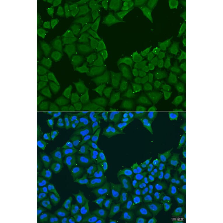 Immunofluorescence - Anti-MAGEA6 Antibody (A10308) - Antibodies.com
