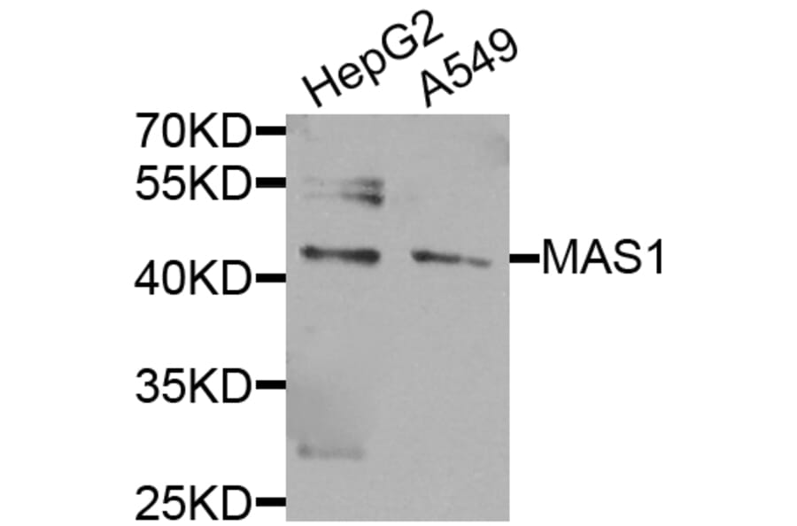 Western Blot - Anti-MAS1 Antibody (A8132) - Antibodies.com