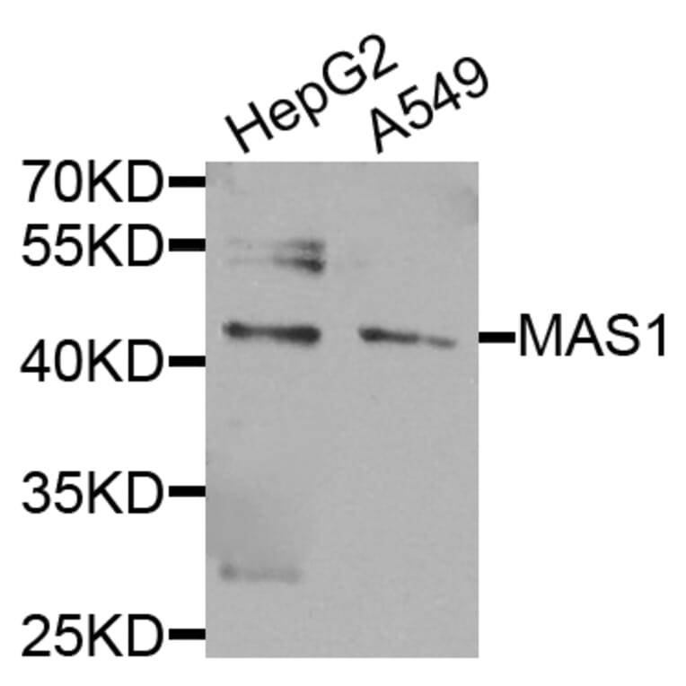 Western Blot - Anti-MAS1 Antibody (A8132) - Antibodies.com