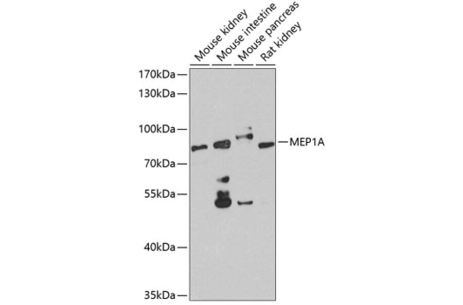 Western Blot - Anti-Meprin alpha Antibody (A10311) - Antibodies.com