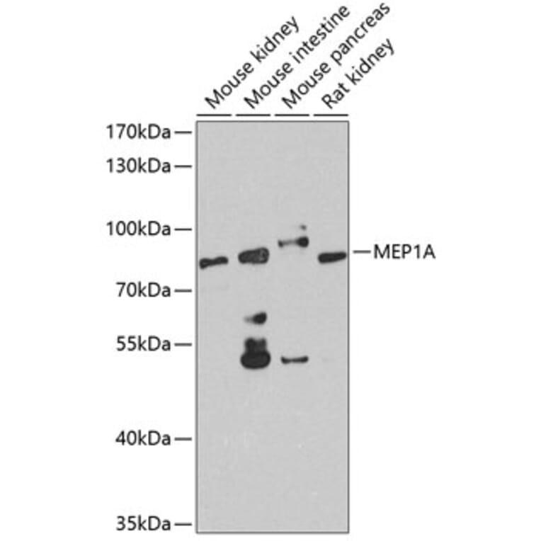 Western Blot - Anti-Meprin alpha Antibody (A10311) - Antibodies.com