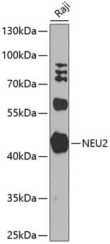 Western blot analysis of extracts of Raji cells, using Anti-NEU2 Antibody (A8137) at 1:1,000 dilution.
Secondary antibody: Goat Anti-Rabbit IgG (H+L) (HRP) (AS014) at 1:10,000 dilution.
Lysates / proteins: 25µg per lane.
Blocking buffer: 3% non-fat dry milk in TBST.
Detection: ECL Basic Kit (RM00020).
Exposure time: 90s.