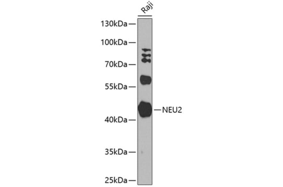 Western Blot - Anti-NEU2 Antibody (A10312) - Antibodies.com