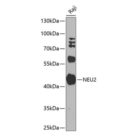 Western Blot - Anti-NEU2 Antibody (A10312) - Antibodies.com
