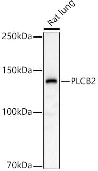 Western blot analysis of extracts of various cell lines, using Anti-PLCB2 Antibody (A8141) at 1:1,000 dilution.
Secondary antibody: Goat Anti-Rabbit IgG (H+L) (HRP) (AS014) at 1:10,000 dilution.
Lysates / proteins: 25µg per lane.
Blocking buffer: 3% non-fat dry milk in TBST.
Detection: ECL Basic Kit (RM00020).
Exposure time: 30s.