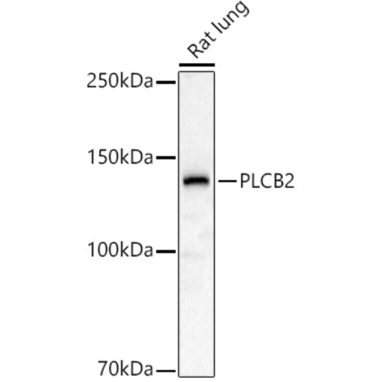 Western Blot - Anti-Phospholipase C beta 2/PLCB2 Antibody (A10313) - Antibodies.com
