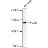 Western Blot - Anti-Phospholipase C beta 2/PLCB2 Antibody (A10313) - Antibodies.com