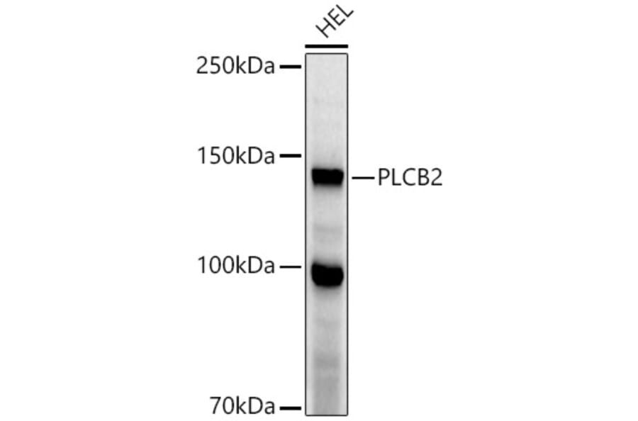Western Blot - Anti-Phospholipase C beta 2/PLCB2 Antibody (A10313) - Antibodies.com