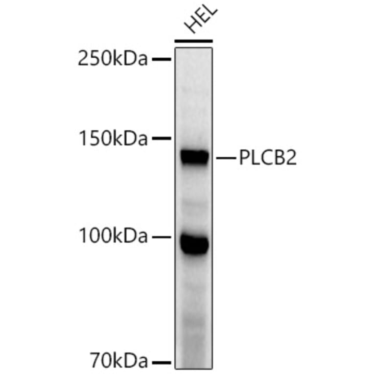 Western Blot - Anti-Phospholipase C beta 2/PLCB2 Antibody (A10313) - Antibodies.com