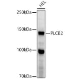 Western Blot - Anti-Phospholipase C beta 2/PLCB2 Antibody (A10313) - Antibodies.com
