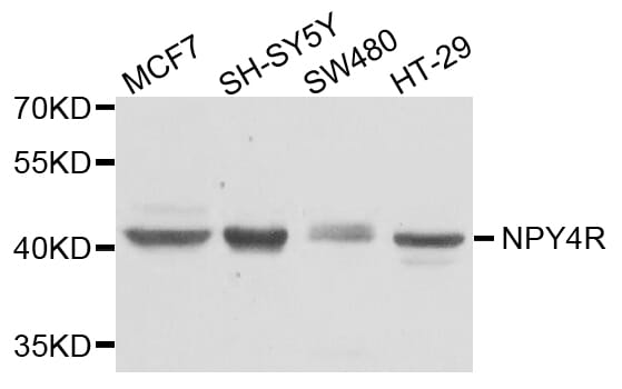 Western blot analysis of extracts of various cell lines, using Anti-NPY4R Antibody (A8143) at 1:1,000 dilution.
Secondary antibody: Goat Anti-Rabbit IgG (H+L) (HRP) (AS014) at 1:10,000 dilution.
Lysates / proteins: 25µg per lane.
Blocking buffer: 3% non-fat dry milk in TBST.
Detection: ECL Basic Kit (RM00020).
Exposure time: 1s.