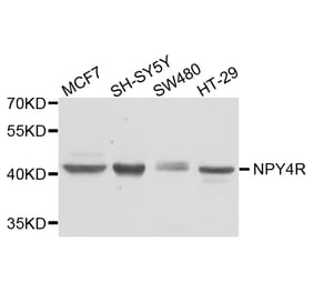 Western Blot - Anti-NPY4R Antibody (A8143) - Antibodies.com