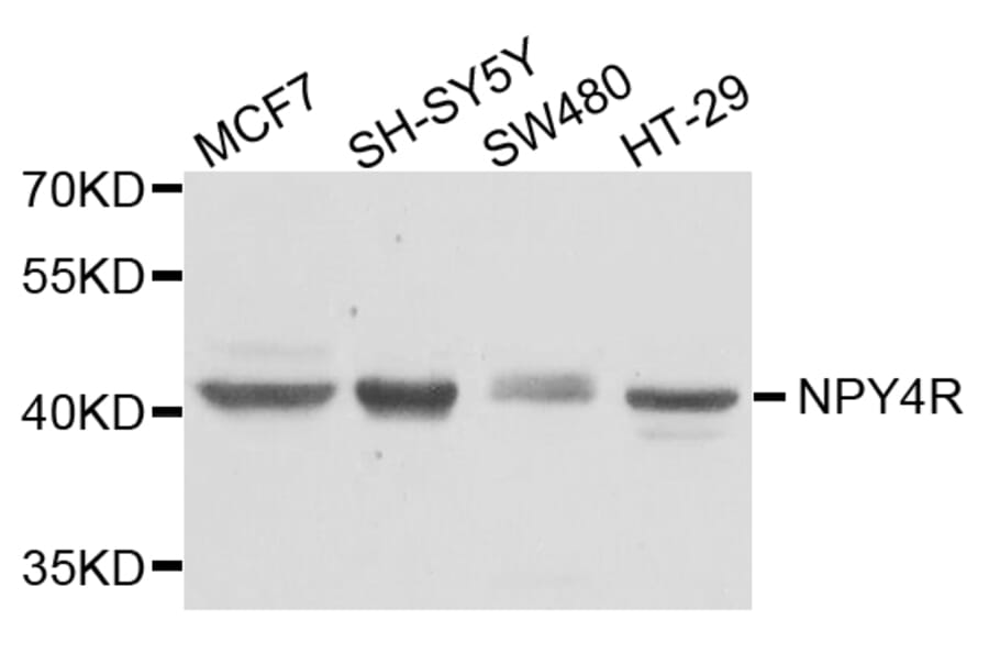 Western Blot - Anti-NPY4R Antibody (A8143) - Antibodies.com