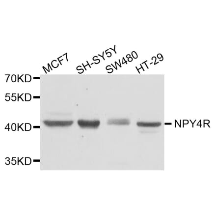 Western Blot - Anti-NPY4R Antibody (A8143) - Antibodies.com