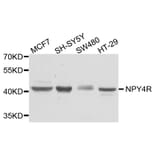 Western Blot - Anti-NPY4R Antibody (A8143) - Antibodies.com