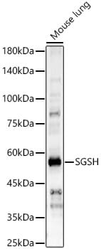 Western blot analysis of extracts of various cell lines, using Anti-SGSH Antibody (A8148) at 1:1,000 dilution.
Secondary antibody: Goat Anti-Rabbit IgG (H+L) (HRP) (AS014) at 1:10,000 dilution.
Lysates / proteins: 25µg per lane.
Blocking buffer: 3% non-fat dry milk in TBST.
Detection: ECL Basic Kit (RM00020).
Exposure time: 10s.