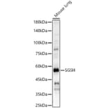 Western Blot - Anti-SGSH/HSS Antibody (A10316) - Antibodies.com
