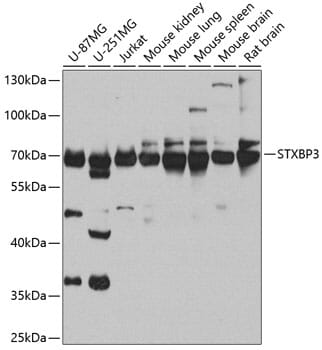 Western blot analysis of extracts of various cell lines, using Anti-STXBP3 Antibody (A8153) at 1:1,000 dilution.
Secondary antibody: Goat Anti-Rabbit IgG (H+L) (HRP) (AS014) at 1:10,000 dilution.
Lysates / proteins: 25µg per lane.
Blocking buffer: 3% non-fat dry milk in TBST.
Detection: ECL Basic Kit (RM00020).
Exposure time: 30s.