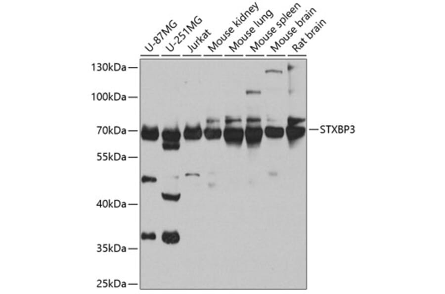 Western Blot - Anti-Munc18c Antibody (A10317) - Antibodies.com