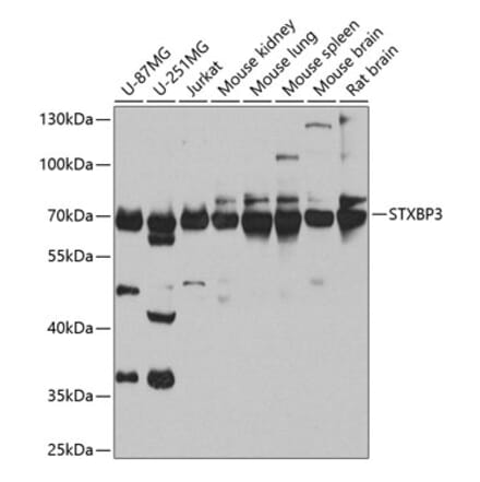 Western Blot - Anti-Munc18c Antibody (A10317) - Antibodies.com