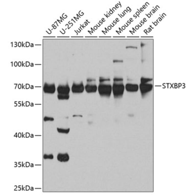 Western Blot - Anti-Munc18c Antibody (A10317) - Antibodies.com