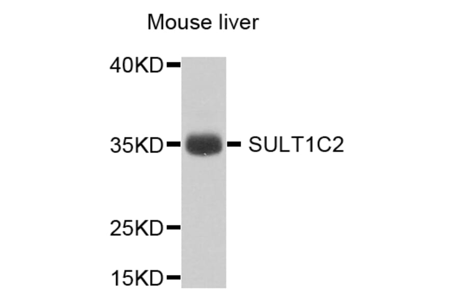 Western Blot - Anti-SULT1C2 Antibody (A8154) - Antibodies.com