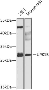 Western blot analysis of extracts of various cell lines, using Anti-UPK1B Antibody (A8157) at 1:1,000 dilution.
Secondary antibody: Goat Anti-Rabbit IgG (H+L) (HRP) (AS014) at 1:10,000 dilution.
Lysates / proteins: 25µg per lane.
Blocking buffer: 3% non-fat dry milk in TBST.
Detection: ECL Basic Kit (RM00020).
Exposure time: 90s.