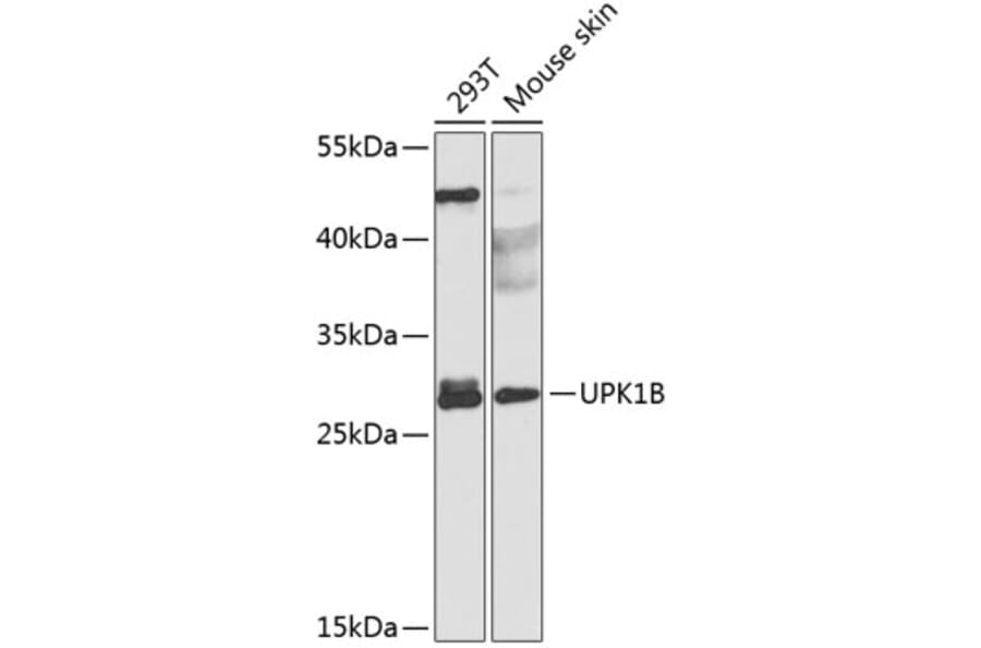 Western Blot - Anti-Uroplakin Ib/UPIb Antibody (A10319) - Antibodies.com