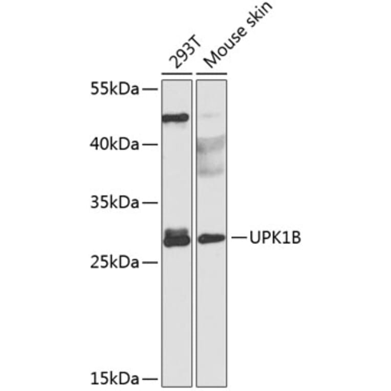 Western Blot - Anti-Uroplakin Ib/UPIb Antibody (A10319) - Antibodies.com