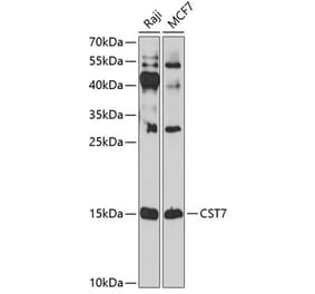 Western Blot - Anti-Cystatin F Antibody (A10321) - Antibodies.com