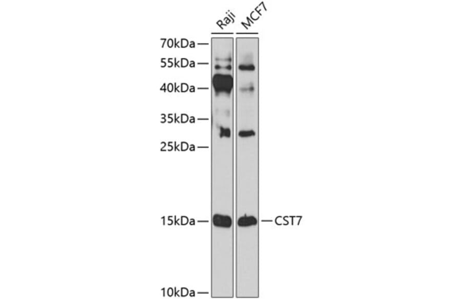 Western Blot - Anti-Cystatin F Antibody (A10321) - Antibodies.com