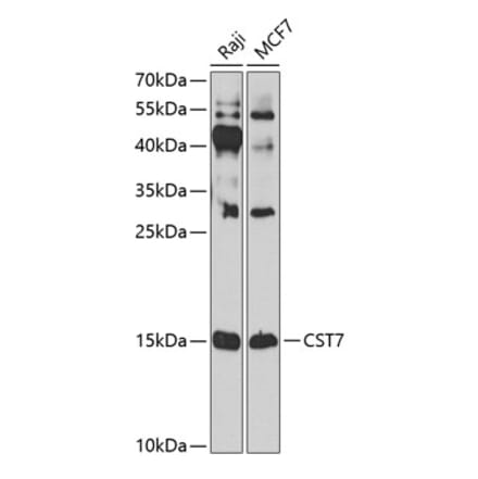 Western Blot - Anti-Cystatin F Antibody (A10321) - Antibodies.com