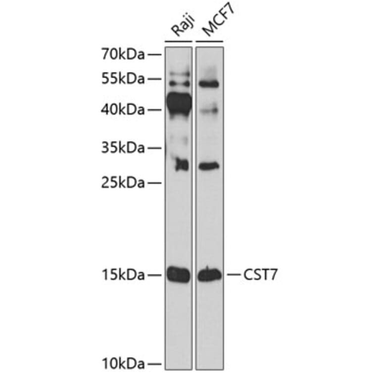 Western Blot - Anti-Cystatin F Antibody (A10321) - Antibodies.com