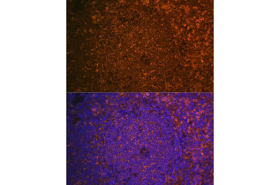 Immunofluorescence - Anti-Cystatin F Antibody (A10321) - Antibodies.com