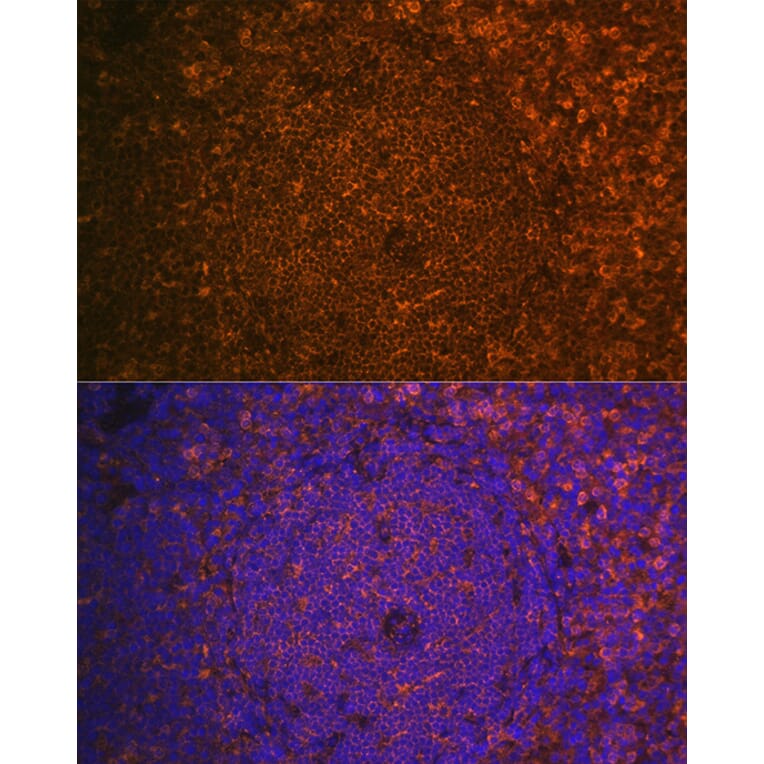 Immunofluorescence - Anti-Cystatin F Antibody (A10321) - Antibodies.com