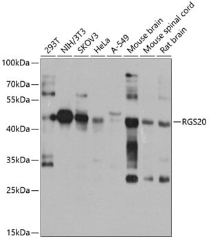 Western blot analysis of extracts of various cell lines, using Anti-RGS20 Antibody (A8167) at 1:1,000 dilution.
Secondary antibody: Goat Anti-Rabbit IgG (H+L) (HRP) (AS014) at 1:10,000 dilution.
Lysates / proteins: 25µg per lane.
Blocking buffer: 3% non-fat dry milk in TBST.
Detection: ECL Basic Kit (RM00020).
Exposure time: 15s.