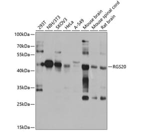 Western Blot - Anti-RGS20 Antibody (A10323) - Antibodies.com