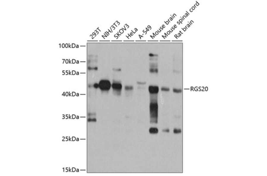 Western Blot - Anti-RGS20 Antibody (A10323) - Antibodies.com