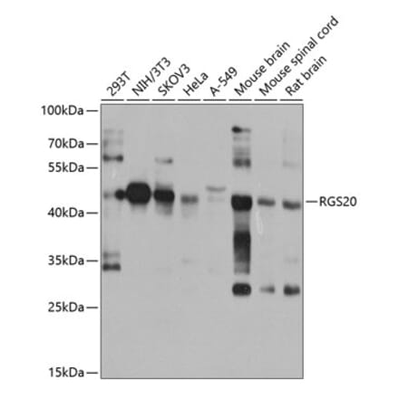 Western Blot - Anti-RGS20 Antibody (A10323) - Antibodies.com