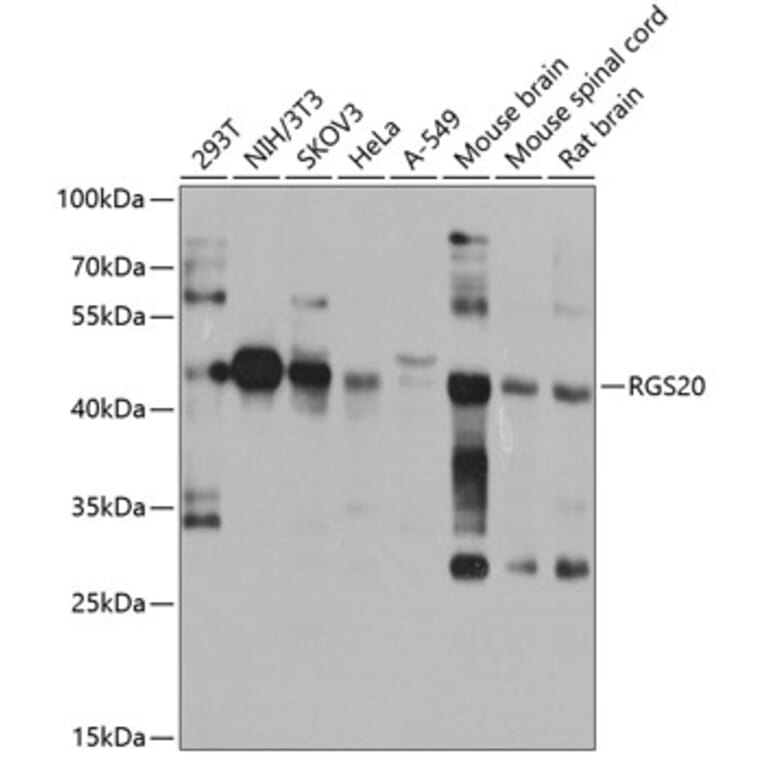 Western Blot - Anti-RGS20 Antibody (A10323) - Antibodies.com
