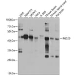Western Blot - Anti-RGS20 Antibody (A10323) - Antibodies.com
