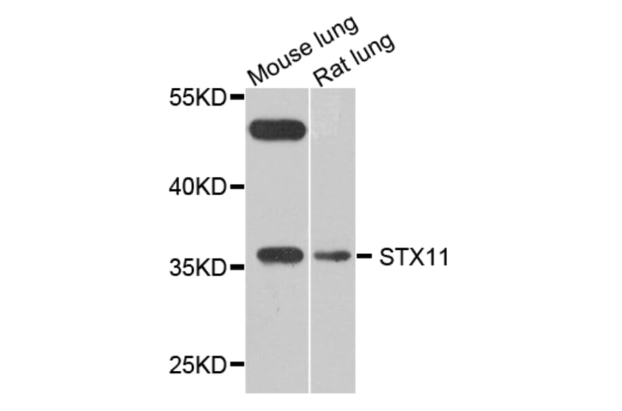 Western Blot - Anti-STX11 Antibody (A8169) - Antibodies.com